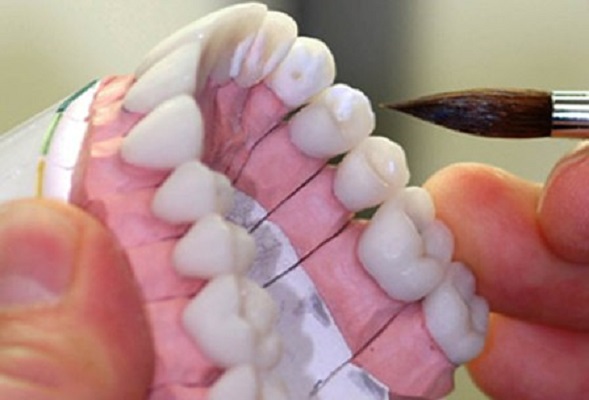 اهمیت خرید و استفاده از تجهیزات و لوازم دندانسازی