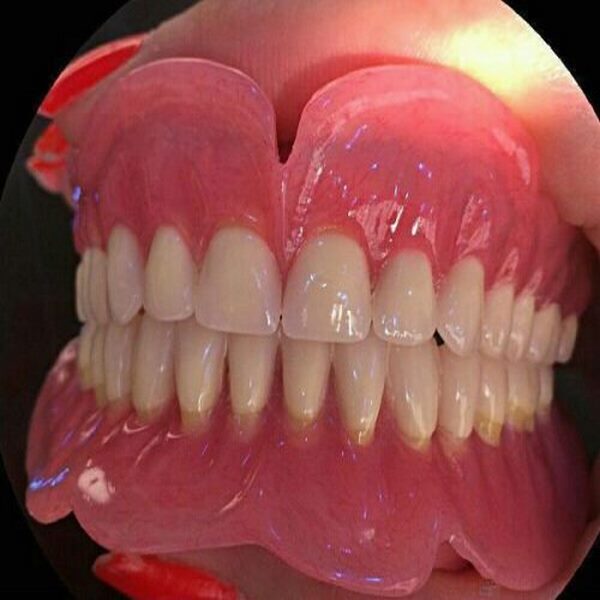 ویژگی های دندان های مصنوعی مدل اپل