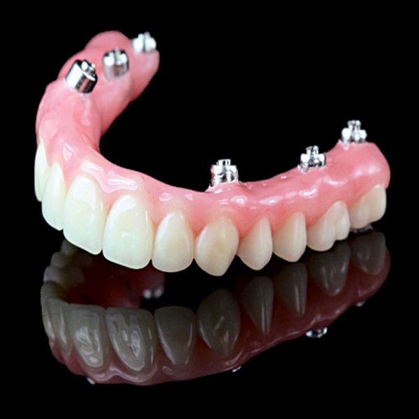 پروتز ثابت و متحرک دندان چیست؟