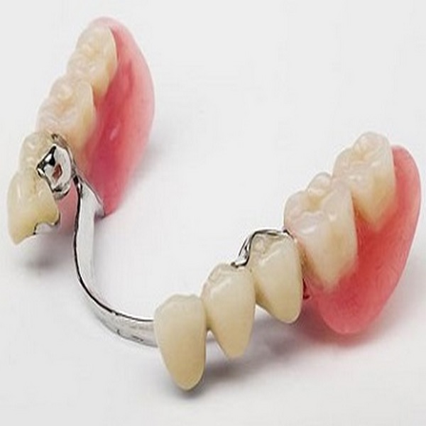 معایب استفاده از انواع ثابت پروتز های دندان