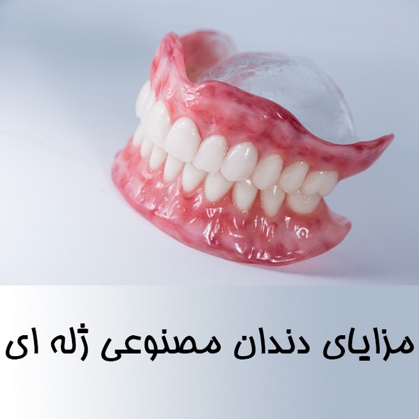مزایای دندان مصنوعی ژله ای