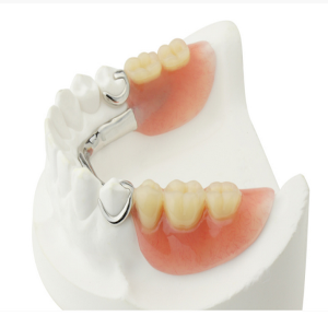 دندان مصنوعی چسبی و متحرک