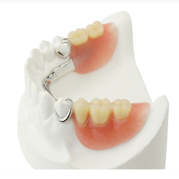 تفاوت دندان مصنوعی چسبی و متحرک