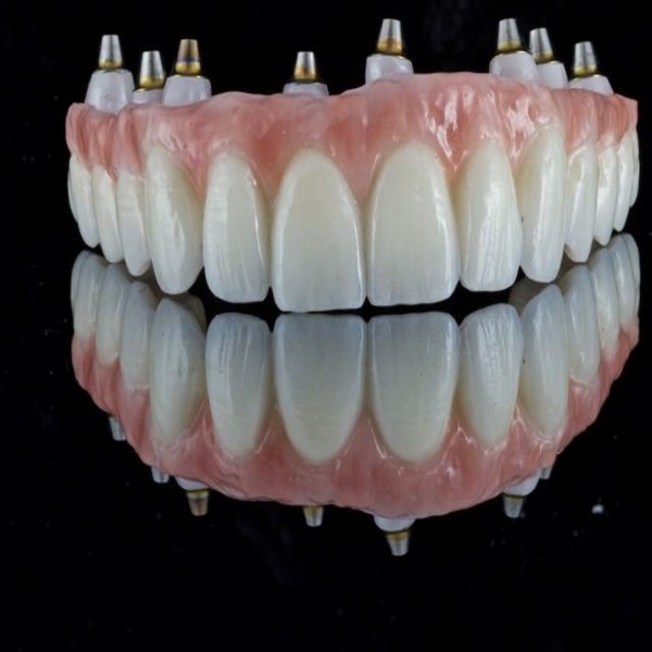 رعایت بهداشت دندان های مصنوعی متحرک