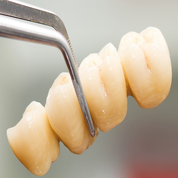 معایب استفاده از دندان مصنوعی متحرک و چسبی