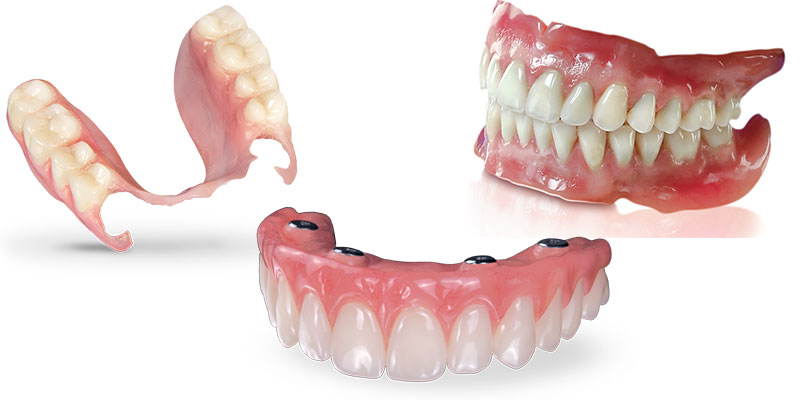 درصد بیمه برای دندان مصنوعی