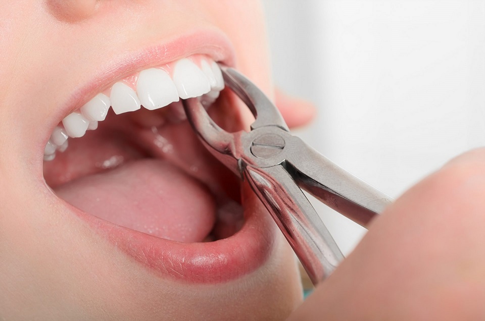 آشنایی با انواع ابزار دندانپزشکی