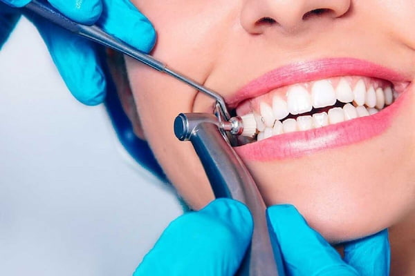نکات مراقبت از دندان پس از جرمگیری چیست؟