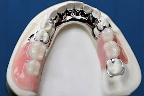 نکات نگهداری ظرف دندان مصنوعی