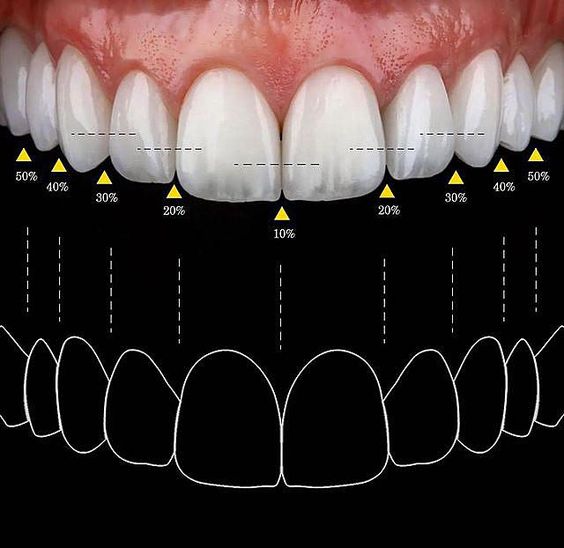 دندان مصنوعی خارجی